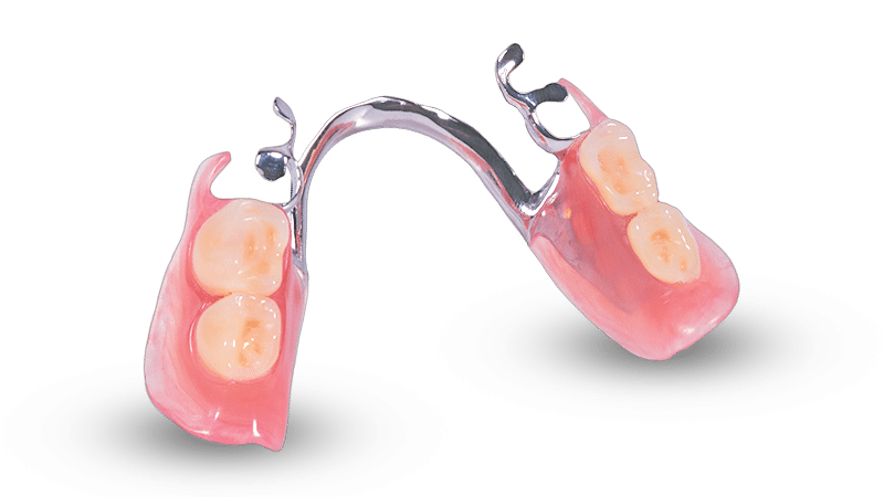 https://glidewelldental.com/content/dam/digital/websites/solutions/removable-prosthesis/patrials/simply-natural-partials/tcs_vitallium_033108_074.png