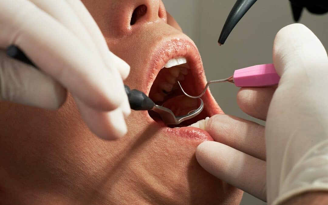 caries et risques cardiovasculaires