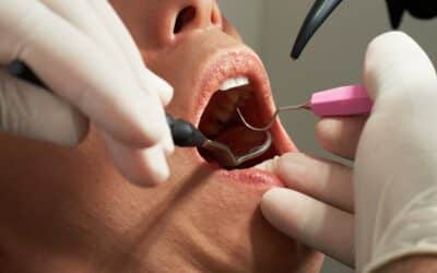 Caries et Risques Cardiovasculaires : Protégez Votre Cœur