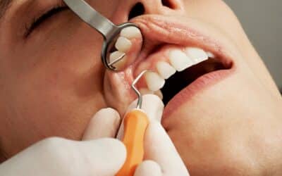 Maladie Odontique: Signes, Prévention & Solutions | Eragny