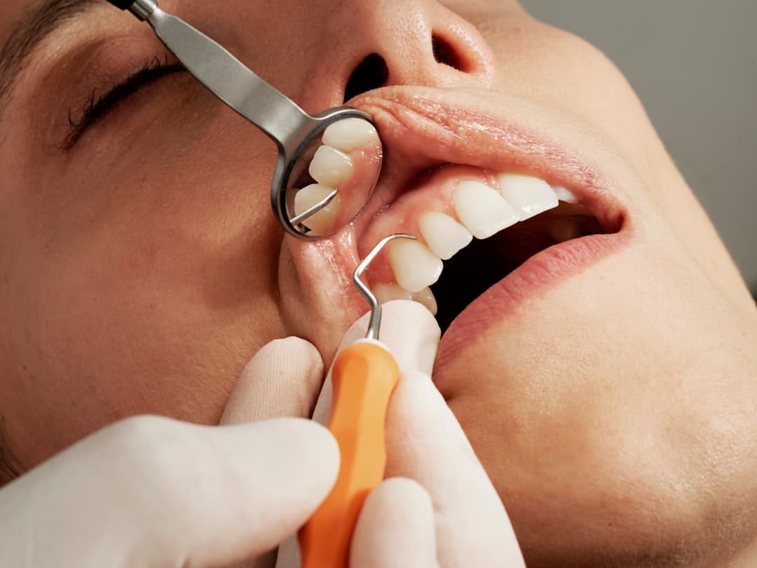 Maladie Odontique: Signes, Prévention & Solutions | Eragny