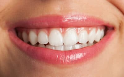 Dents jaunes après endodontie : conseils pratiques