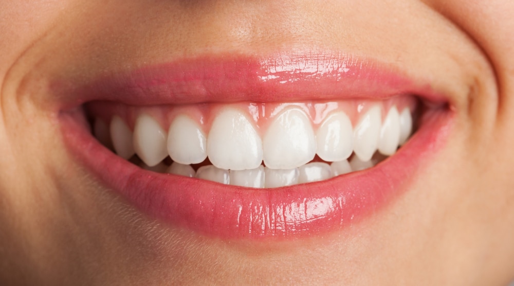 Dents jaunes après endodontie : conseils pratiques